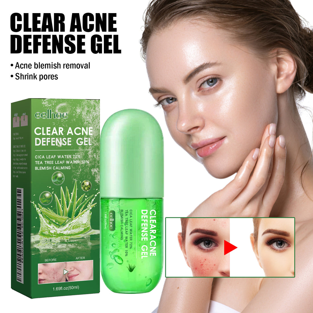 Clear Acne Defense Gel